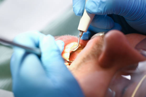 Best Emergency Dental Care for Broken or Chipped Teeth in Hlcrest, IL