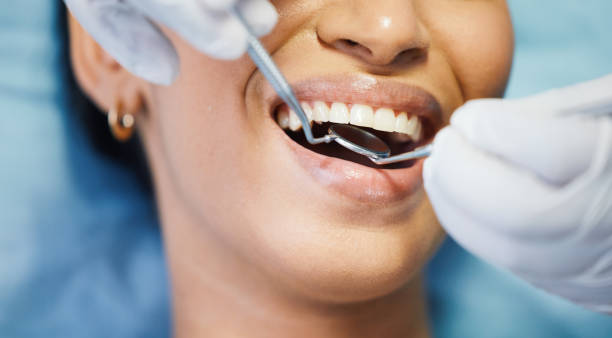 Best Urgent Care for Lost Fillings or Crowns in Hlcrest, IL