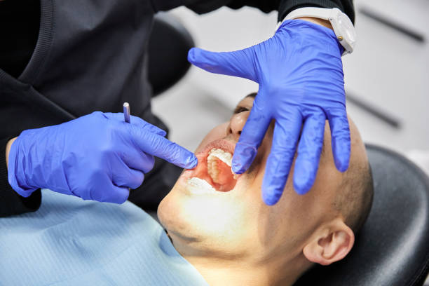 Best Emergency Tooth Extraction in Hlcrest, IL