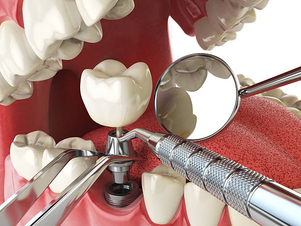 Best Emergency Dental Care for Broken or Chipped Teeth in Hlcrest, IL